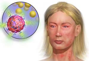 Аптечка при анафилактическом шоке