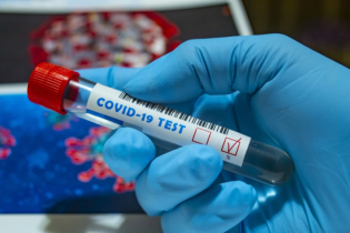 В Украине выявлено более 15 тысяч случаев заражения коронавирусом